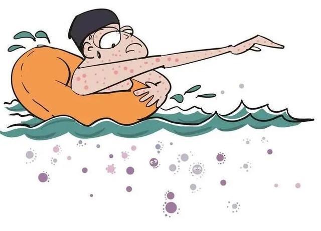 1751091573277906.jpeg 游泳池細菌2.jpeg